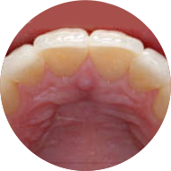 Instant Orthodontics